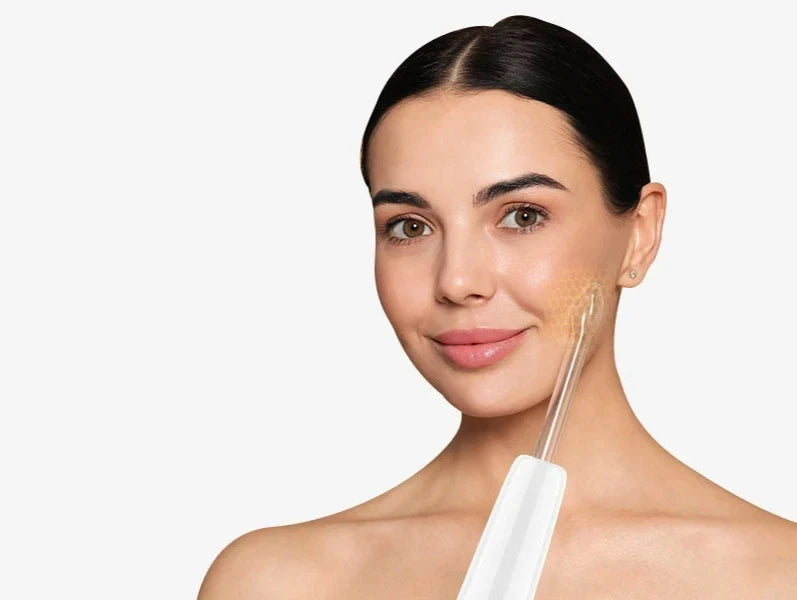 שרביט התדר גבוה